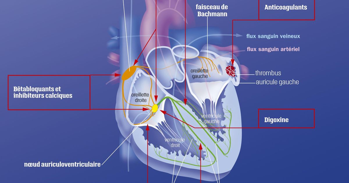 fibrilation atriale pdf